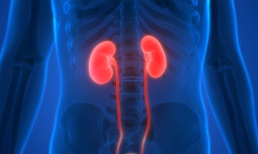 Kidney stones or kidney failure is also a health risk of obesity 