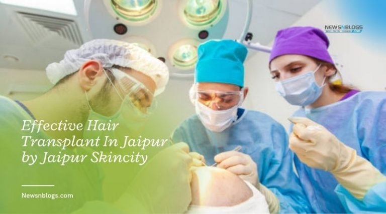 Effective Hair Transplant In Jaipur by Jaipur Skincity