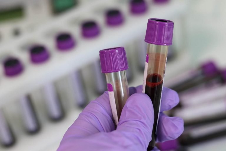 Blood tests