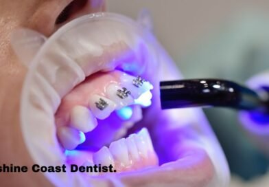 How much do braces cost sunshine Coast dentist.
