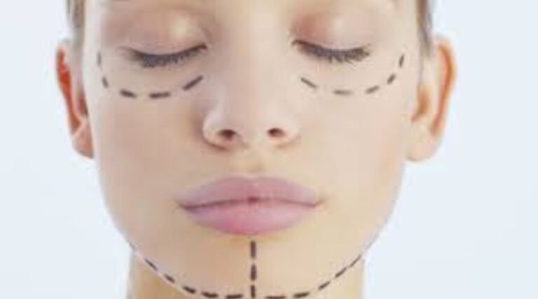 Why Are Cosmetic Surgeries Gaining So Much Acceptance Among People?