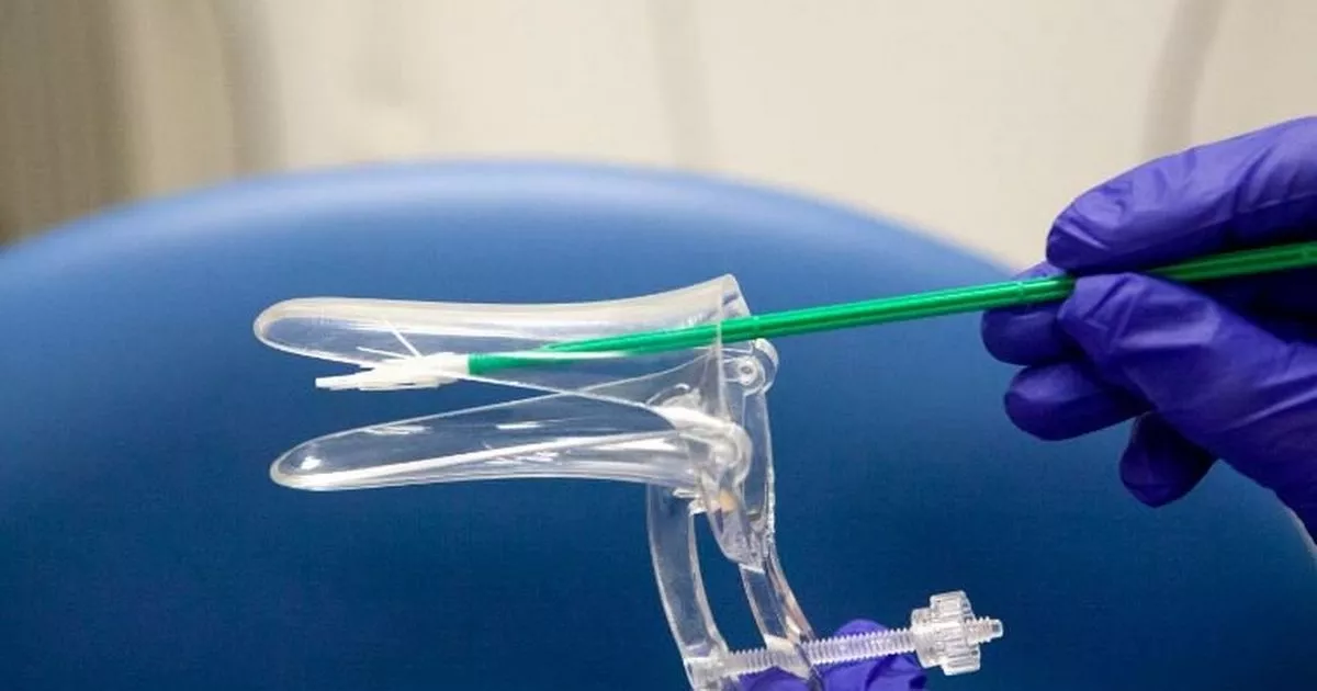 Smear Test