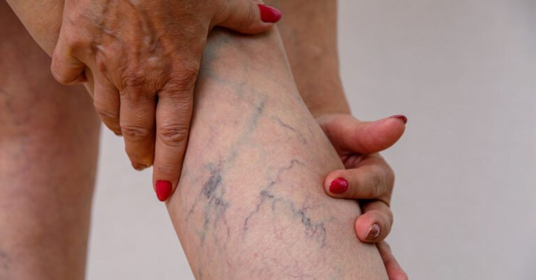 Vascular Veins