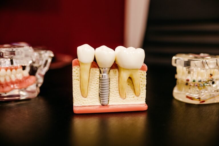 Lab’s Implant Components
