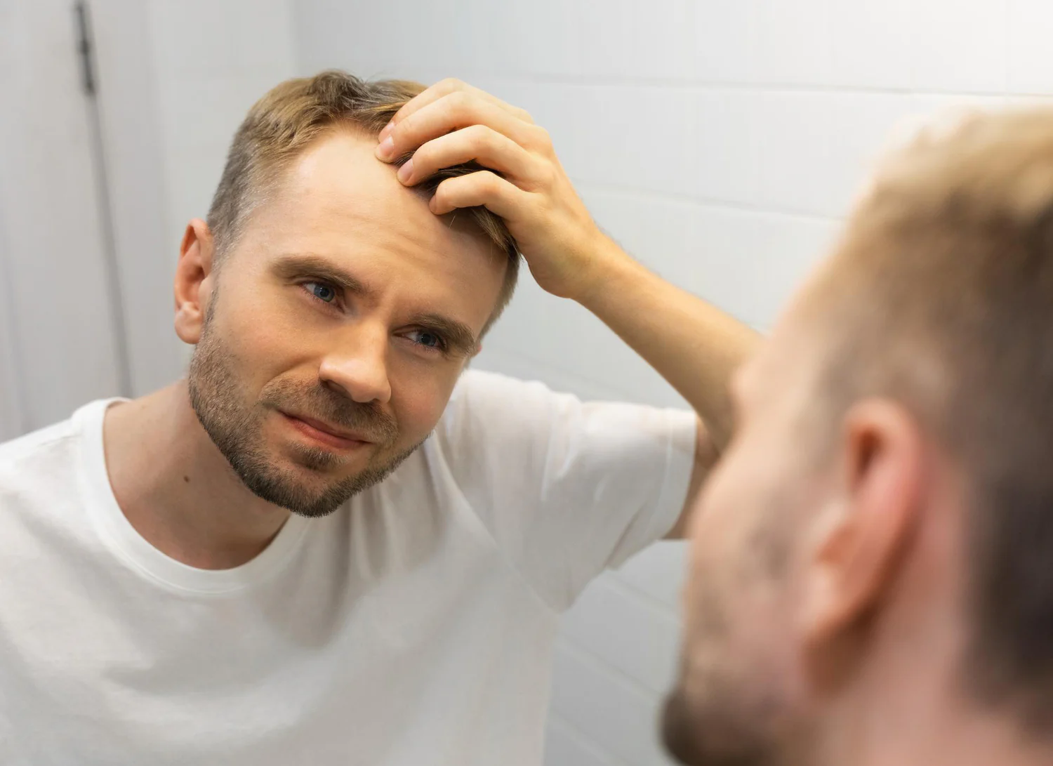Hair Loss