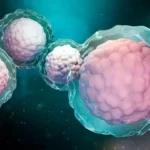 Stem Cell Myelofibrosis