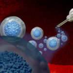 stem cell transplant